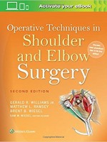 Operative Techniques in Shoulder and Elbow Surgery (2/e)