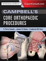 Campbell's Core Orthopaedic Procedures