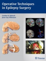 Operative Techniques in Epilepsy Surgery