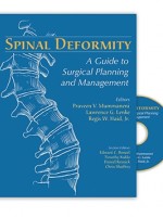 Spinal Deformity A Guide to Surgical Planning and Management