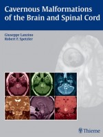 Cavernous Malformations of the Brain and Spinal Cord