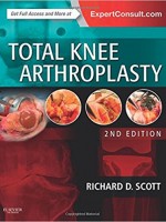 Total Knee Arthroplasty (2/e)