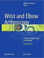 Wrist and Elbow Arthroscopy: A Practical Surgical Guide to Techniques,2/e