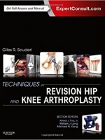 Techniques in Revision Hip and Knee Arthroplasty