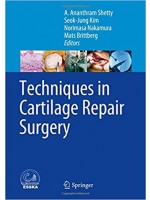 Techniques in Cartilage Repair Surgery