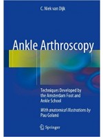 Ankle Arthroscopy: Techniques Developed by the Amsterdam Foot and Ankle School