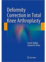 Deformity Correction in Total Knee Arthroplasty