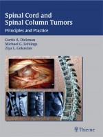 Spinal Cord and Spinal Column Tumors Principles and Practice