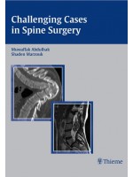 Challenging Cases in Spine Surgery