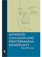 Advanced Caucasian and Mediterranean Rhinoplasty 1st Edition