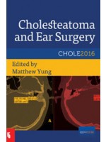 Cholesteatoma and Ear Surgery: An Update 2017