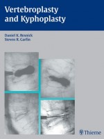 Vertebroplasty and Kyphoplasty