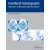 Cerebral Vasospasm Advances in Research and Treatment