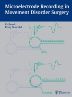 Microelectrode Recording in Movement Disorder Surgery