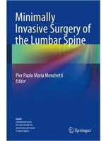 Minimally Invasive Surgery of the Lumbar Spine