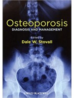 Osteoporosis: Diagnosis and Management