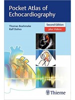 Pocket Atlas of Echocardiography , 2e