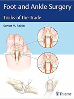 Foot and Ankle Surgery: Tricks of the Trade