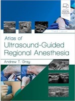 Atlas of Ultrasound-Guided Regional Anesthesia, 3/e