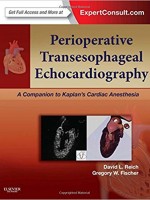 Perioperative Transesophageal Echocardiography