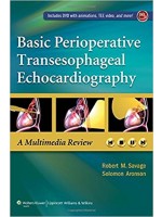 Basic Perioperative Transesophageal Echocardiography