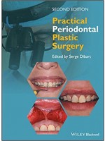 Practical Periodontal Plastic Surgery , 2/e