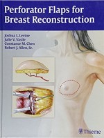 Perforator Flaps for Breast Reconstruction