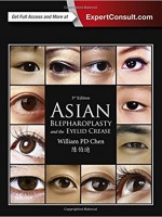 Asian Blepharoplasty and the Eyelid Crease, 3/e