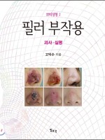 필러 부작용 ― 괴사∙실명(쁘띠성형Ⅰ)