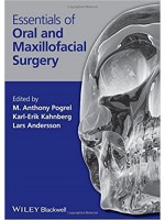 Essentials of Oral and Maxillofacial Surgery