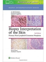 Biopsy Interpretation of the Skin: Primary Non-Lymphoid Cutaneous Neoplasia, 2/e