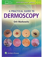 A Practical Guide to Dermoscopy