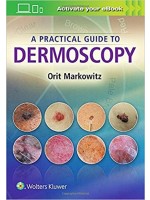 A Practical Guide to Dermoscopy