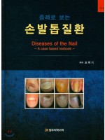 증례로 보는 손발톱질환-Diseases of the Nail, 2판