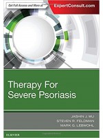 Therapy for Severe Psoriasis