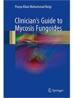 Clinician's Guide to Mycosis Fungoides