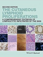 The Cutaneous Lymphoid Proliferations , 2/e