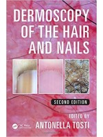 Dermoscopy of the Hair and Nails, 2/e