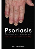 Psoriasis: Diagnosis and Management