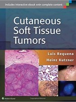 Cutaneous Soft Tissue Tumors