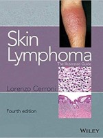 Skin Lymphoma: The Illustrated Guide, 4/e