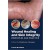 Wound Healing and Skin Integrity: Principles and Practice