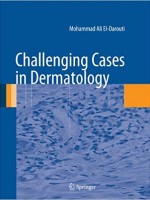 Challenging Cases in Dermatology