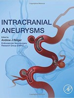 Intracranial Aneurysms