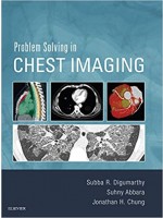 Problem Solving in Chest Imaging, 1st Edition