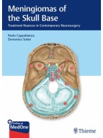 Meningiomas of the Skull Base