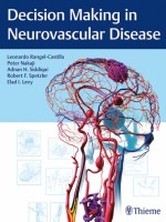 Decision Making in Neurovascular Disease
