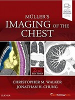 Muller's Imaging of the Chest, 2e