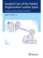 Surgical Care of the Painful Degenerative Lumbar Spine