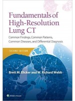 Fundamentals of High-Resolution Lung CT, 2e